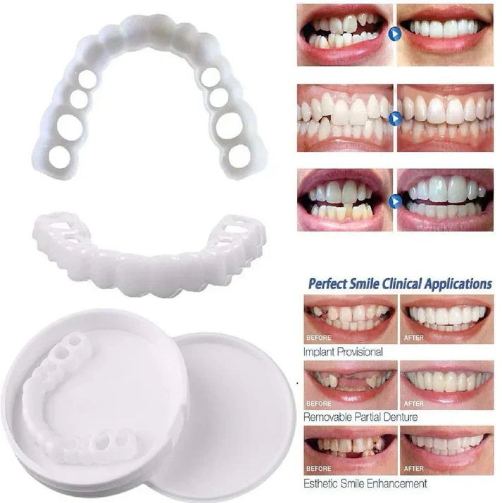 SnapOn Smile Dental Veneers – قشرة ابتسامة سناب أون