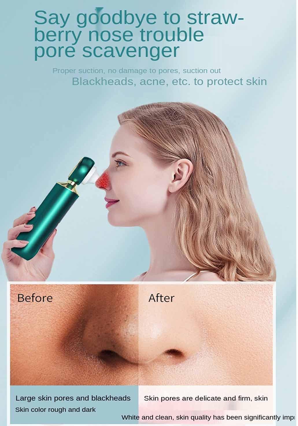Blackhead remover rechargeable _ مزيل الرؤوس السوداء القابل لإعادة الشحن